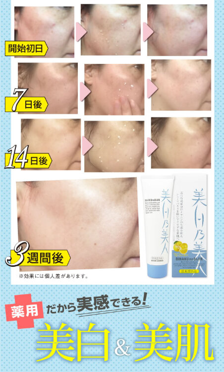 BRAIN COSMOS BIHAKU no BIJIN Medicated Peeling Gel / Лечебный отбеливающий пилинг-гель для лица ,120 гр.